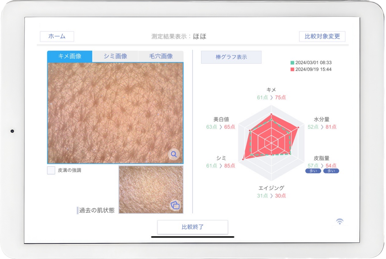 レーダーチャートでお肌状態を表示する画面