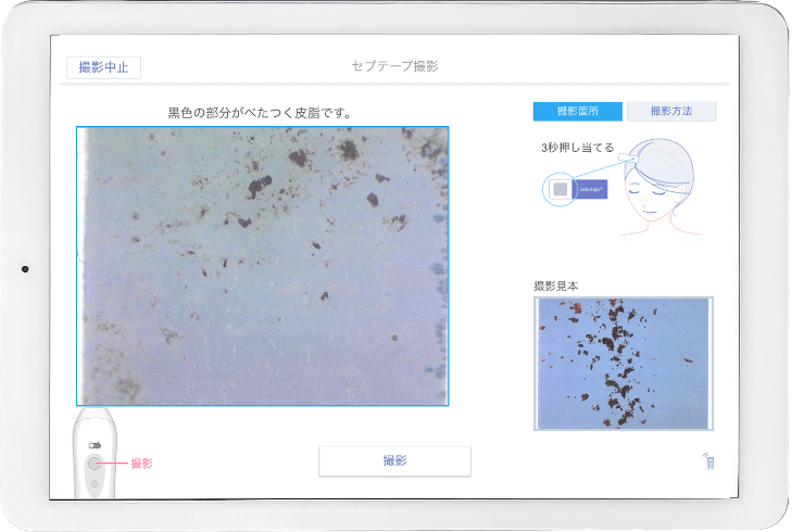 頭皮の油分の表示例