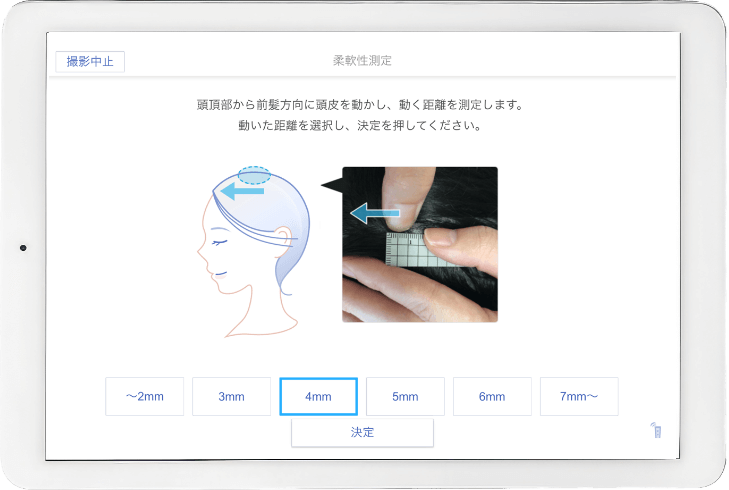 髪痩せの表示例