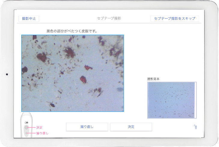 皮脂量測定画面の表示例