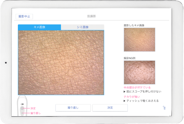 キメ測定画面の表示例