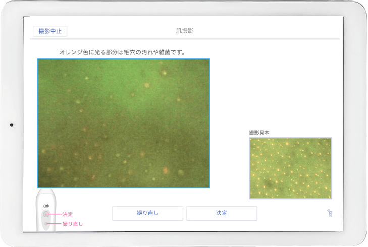 毛穴測定画面の表示例